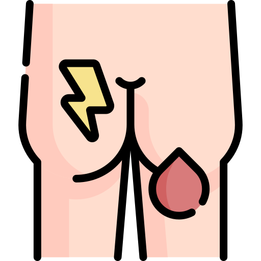 hemorrhoids (1)