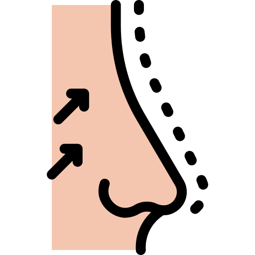 rhinoplasty